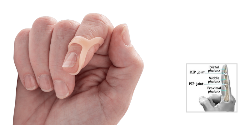 What are the causes of and treatments for deformed fingers?